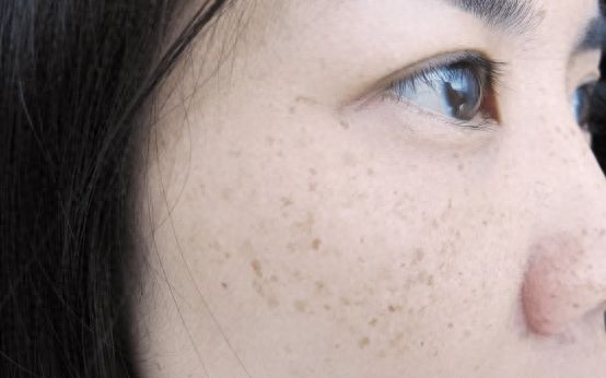 脸上有斑吃维生素几能有效,祛斑用什么方法最好最有效，长斑困扰你吗？试试这样做吧，恢复亮丽肌肤！