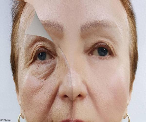 去除老年斑最佳方法,老年斑一擦就掉方法，脸上出现老年斑怎么办？这3招或能淡化色斑，不妨试试！