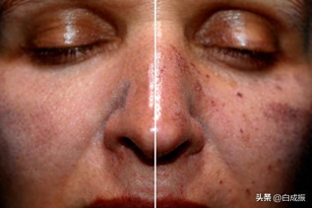 脸部出现斑点是怎么回事,脸上斑点是什么原因引起，面部斑点解析：了解并应对六种常见斑痕